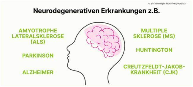 Zusammenhang zwischen Neurodegenerativen Erkrankungen: Demenz, Alzheimer, Parkinson und Amnesie